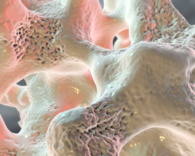 osteoporosis bone image