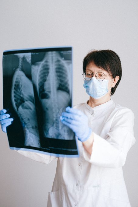 doctor holding xray