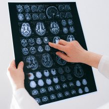 brain scan