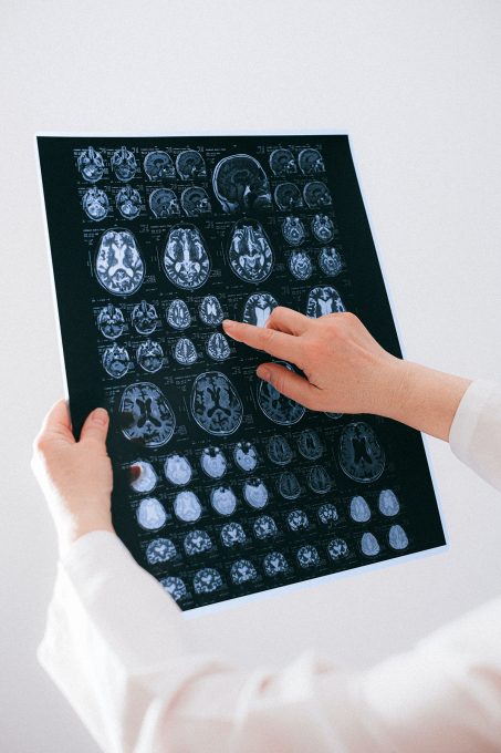 brain scan