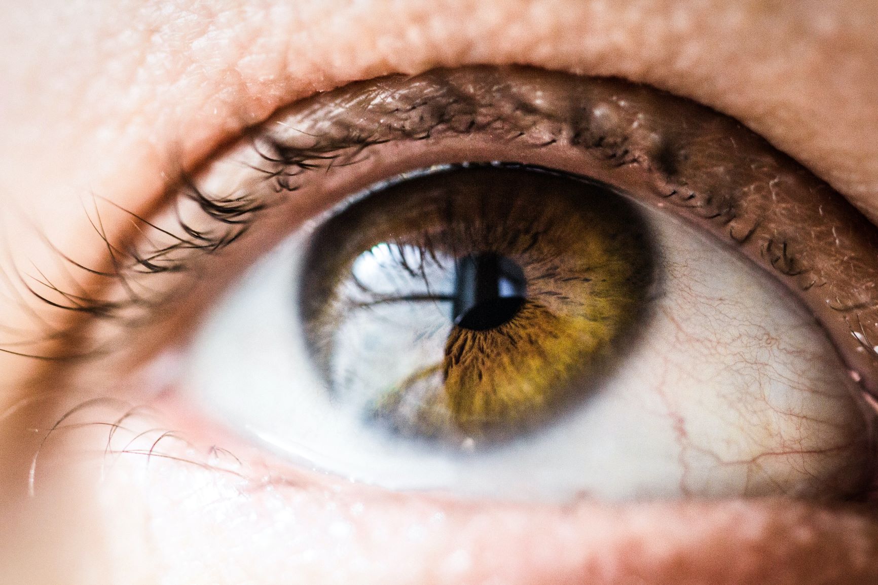 eyes